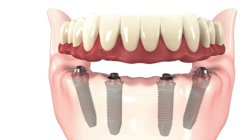 dental